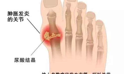 化疗病人能吃蛋白粉吗-化疗病人能吃香菇吗网 - 网站提供化疗病人能吃鸽子吗小常识、化疗病人能吃红薯吗